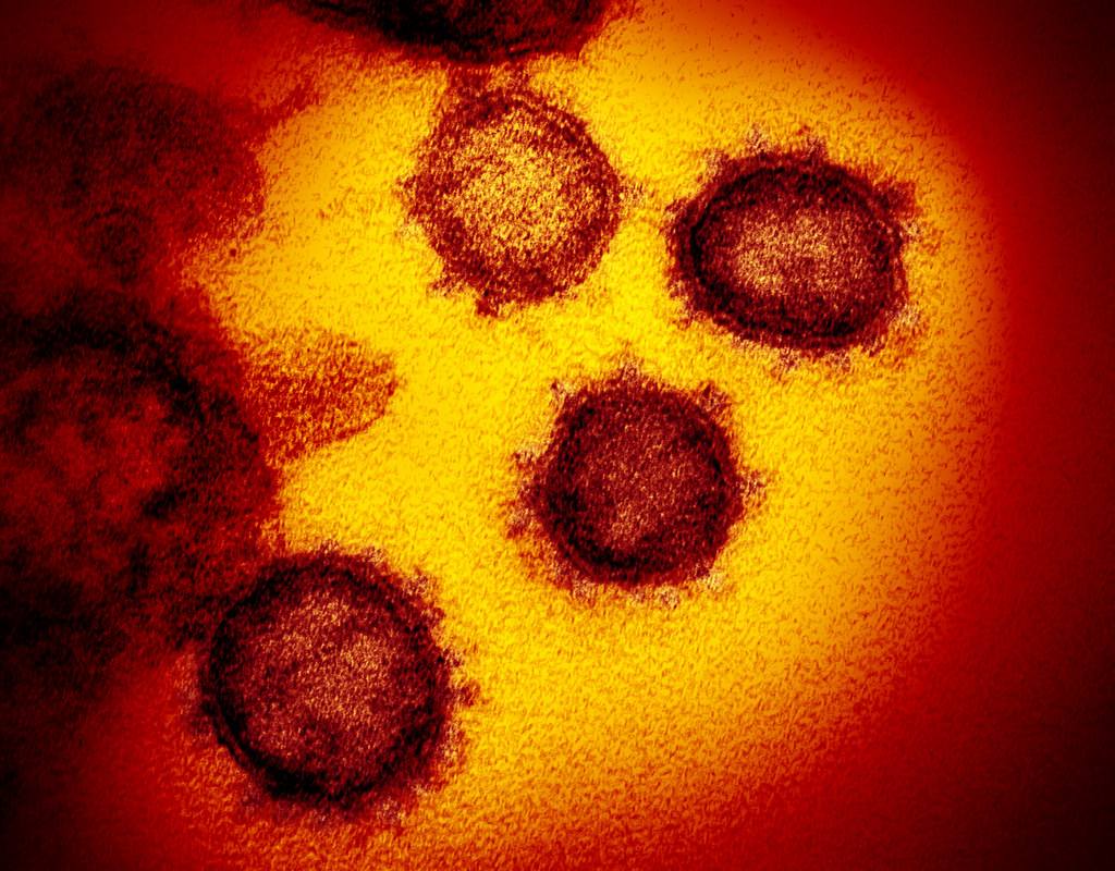 New database: Coronavirus Research from ProQuest